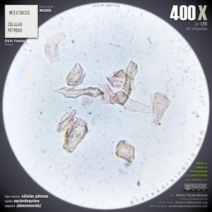 Esclerénquima: Células pétreas